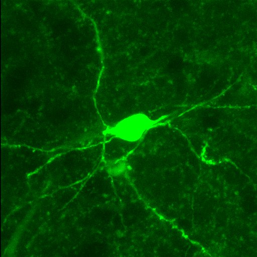 Microscope image: Neon green blob on black background