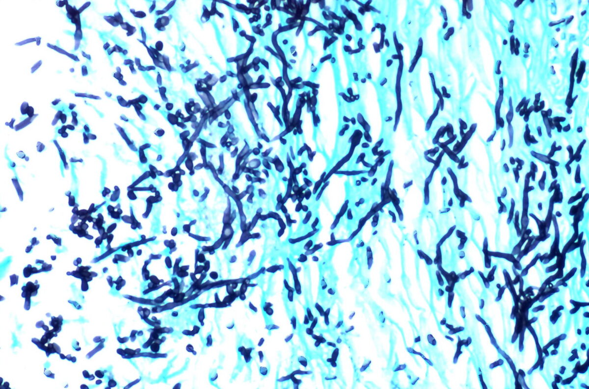 microscope image of rod-shaped dark puple cells on a cyan-streaked background