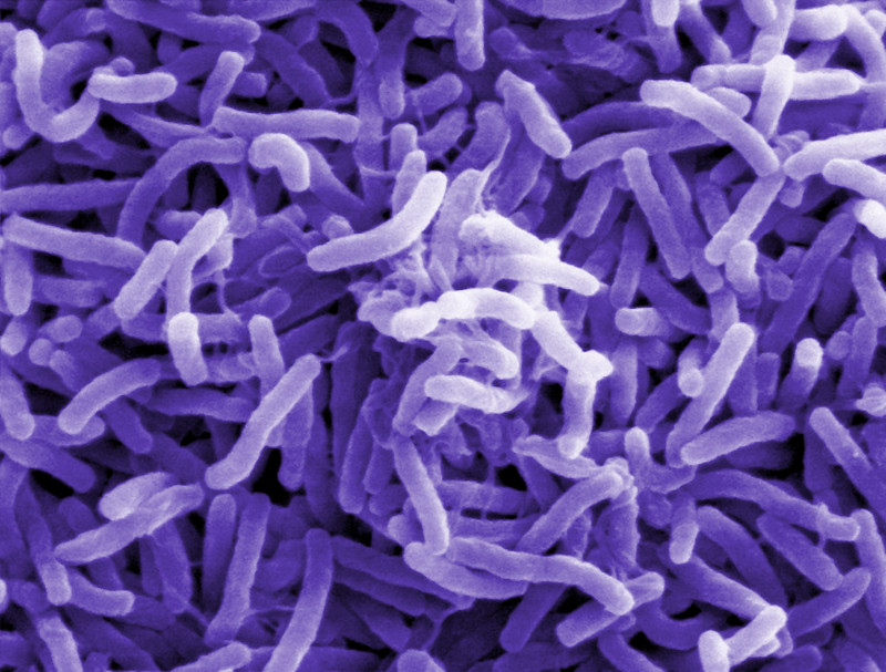 purple, rod-shaped bacterial cells