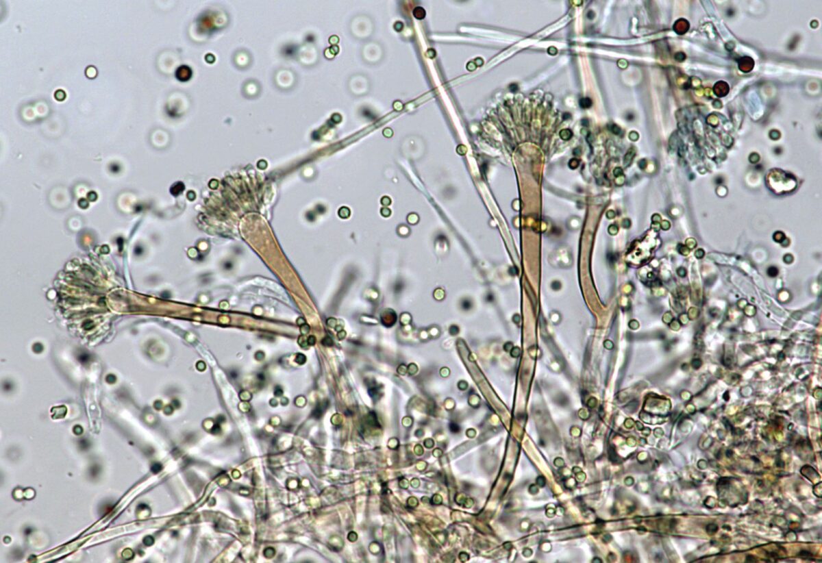 Mold under the microscope shows thin filaments and round dots.