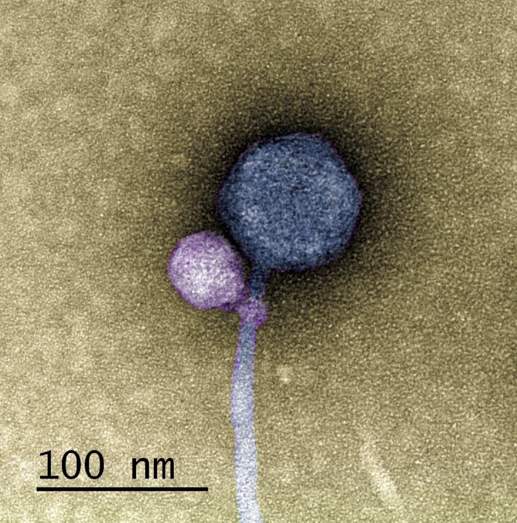 A microscope image of the helper virus and satellite virus attached together. The helper is a large blue ball with a long light blue tail. The satellite is a small purple ball with a tiny purple loop wrapped around the light blue tail, right next to the blue ball. Tan background.
