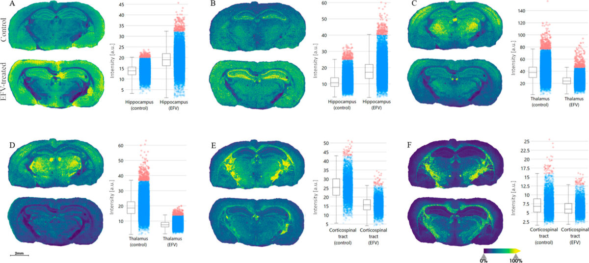 six pairs of brain images, each with a different pattern of blue, green, and yellow. Beside each pair, a bar chart with two bars showing the quantified intensity difference between samples treated with HIV drug Efavirenz and untreated samples.