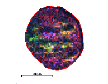 roughly circular shape with pixelated interior in pink, red, green, yellow, and black; scale bar indicates about half the diameter of the circle is 500 um. 