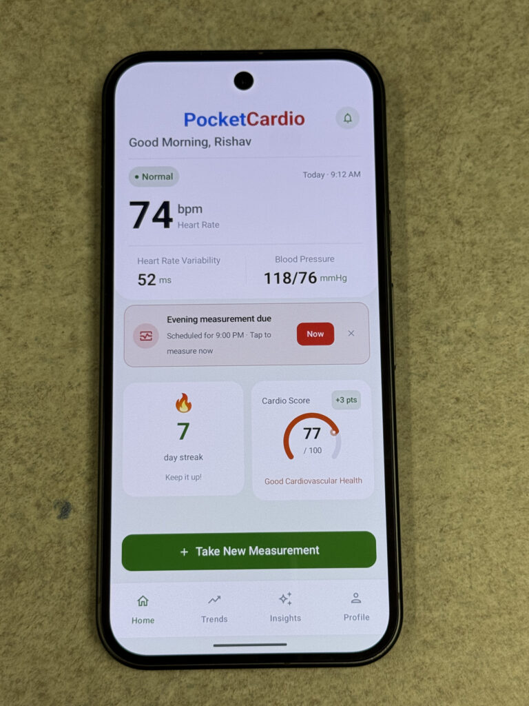 Phone screen displays the PocketCardio app